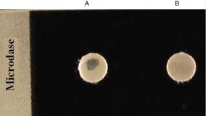 Microdase Test – Principle, Procedure, Result