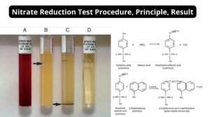 Nitrate Reduction Test – Procedure, Principle, Result