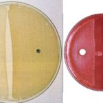 Novobiocin Susceptibility Test Principle, Procedure, Results
