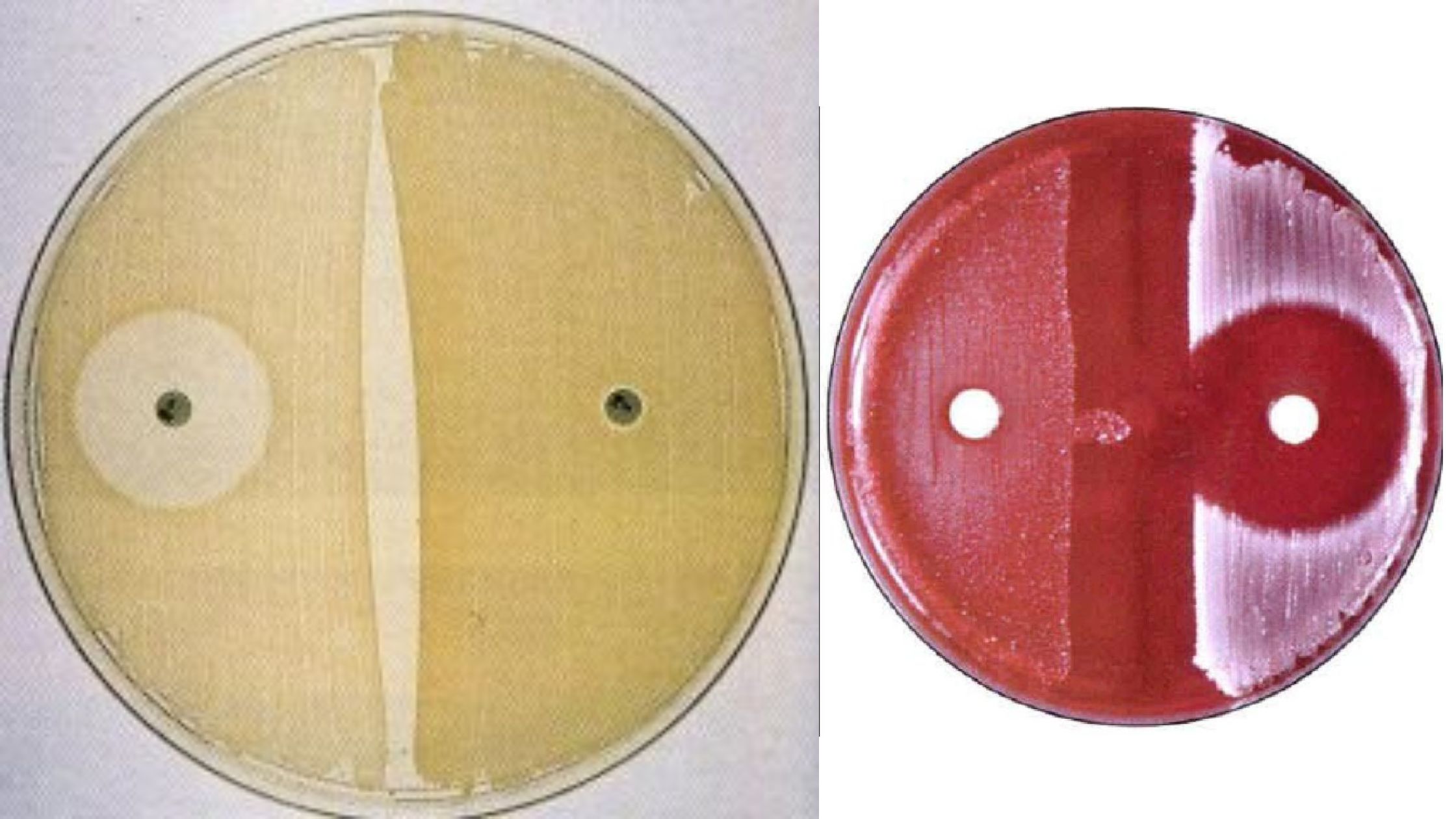 Novobiocin Susceptibility Test Principle, Procedure, Results