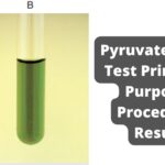 Pyruvate Broth Test Principle, Purpose, Procedure, Result