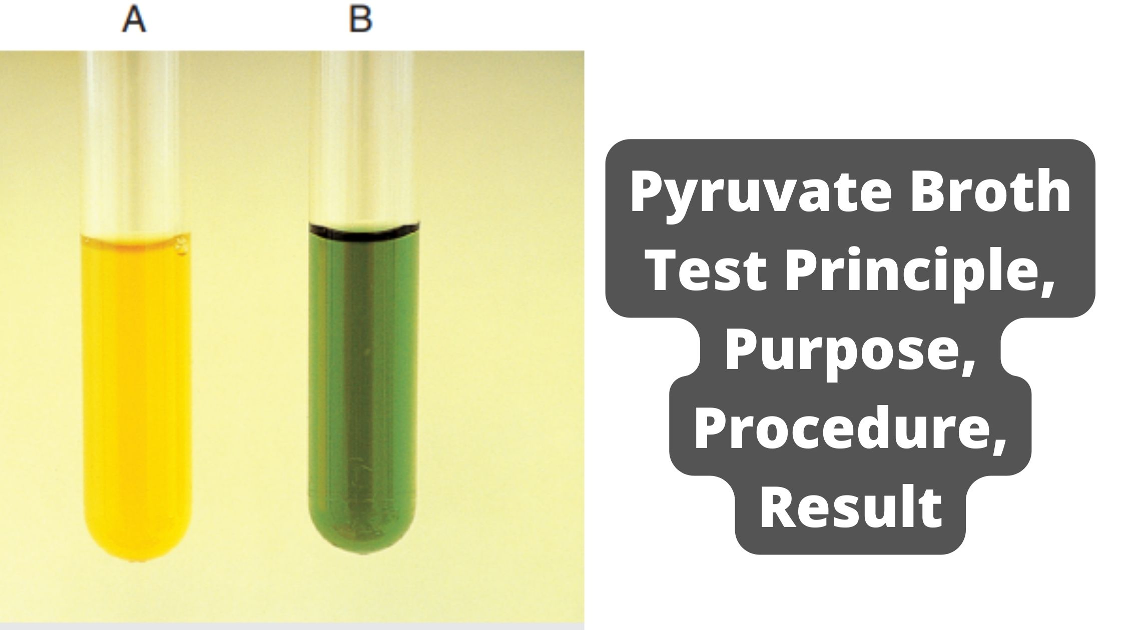 Pyruvate Broth Test Principle, Purpose, Procedure, Result