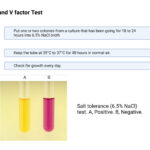 Salt Tolerance Test Principle, Purpose, Procedure, Result