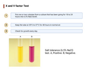 Salt Tolerance Test – Principle, Purpose, Procedure, Result