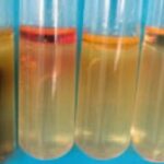Sulfur Reduction Test - Principle, Purpose, Procedure, Result