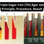Triple Sugar Iron (TSI) - Test Principle, Procedure, Result