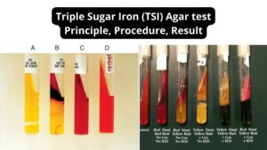 Triple Sugar Iron (TSI) – Test Principle, Procedure, Result