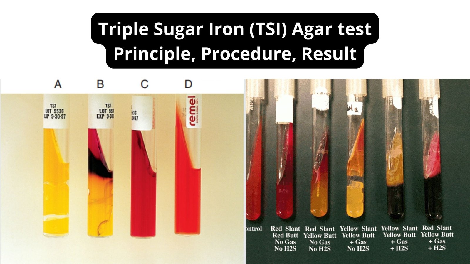 Triple Sugar Iron (TSI) - Test Principle, Procedure, Result