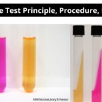 Urease Test Principle, Procedure, Result