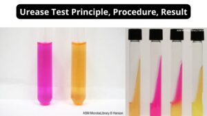 Urease Test – Principle, Procedure, Result