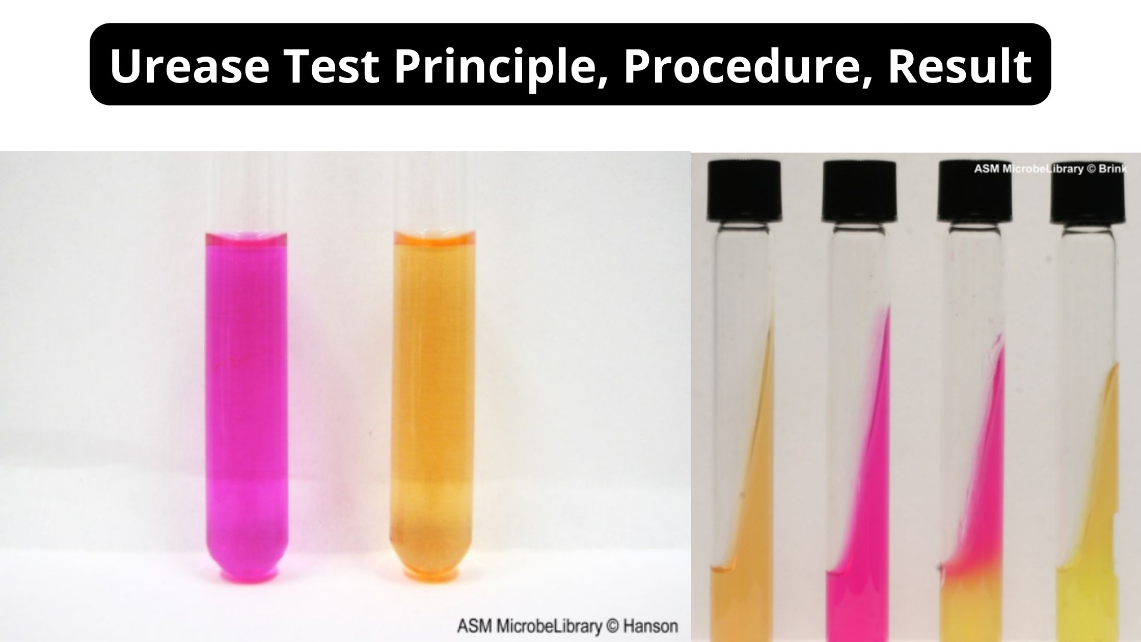 Urease Test Principle, Procedure, Result