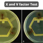 X and V factor Test Principle, Purpose, Procedure, Result