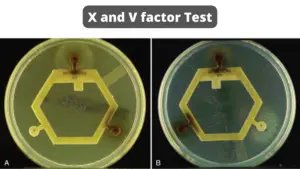 X and V factor Test – Principle, Purpose, Procedure, Result