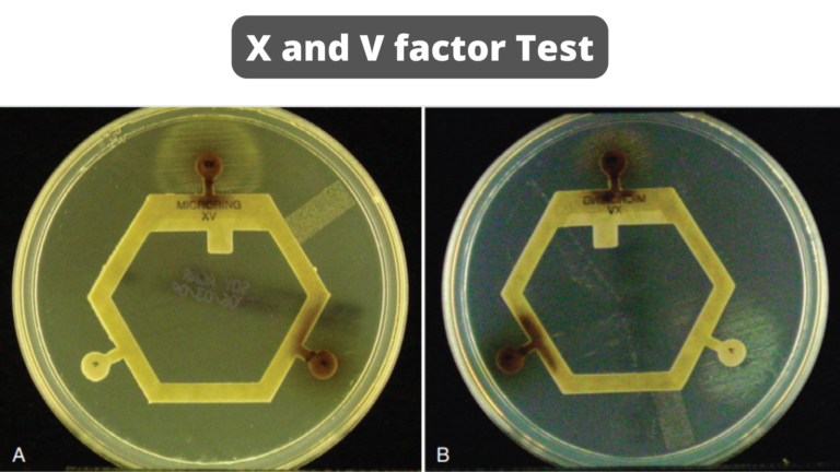 X and V factor Test Principle, Purpose, Procedure, Result