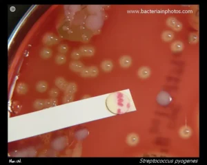 PYR Test (Pyrrolidonyl Arylamidase (PYR) test) – Principle, Procedure, Result