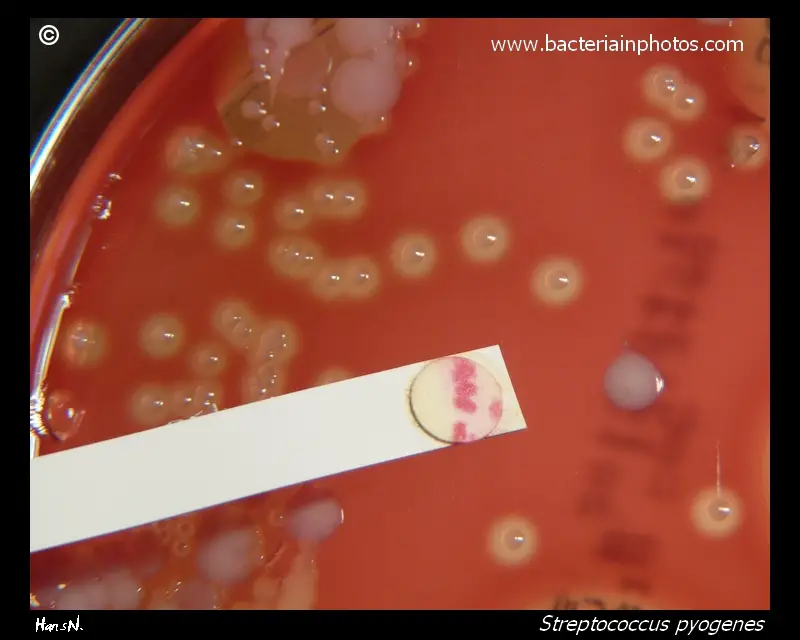 PYR Test (Pyrrolidonyl Arylamidase (PYR) test) - Principle, Procedure, Result