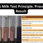 Litmus Milk Test Principle, Procedure, Result