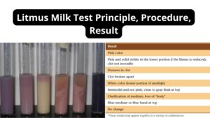 Litmus Milk Test – Principle, Procedure, Result