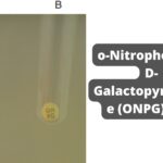 o-Nitrophenyl-b-D-Galactopyranoside (ONPG) Test Principle, Procedure