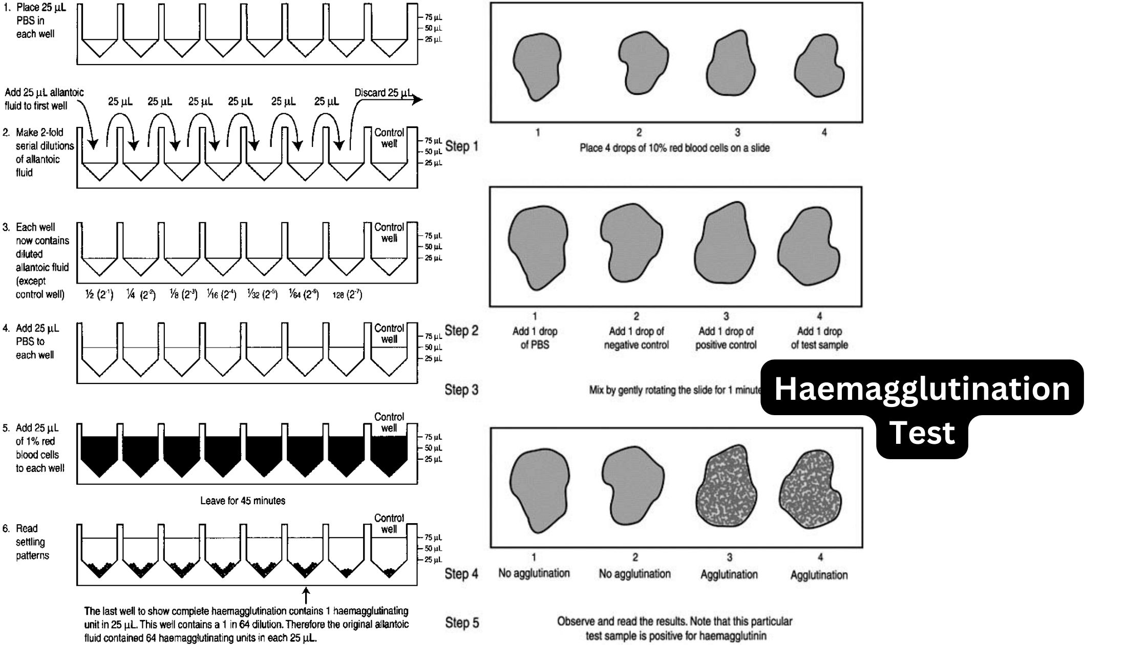 Hemagglutination Inhibition Test