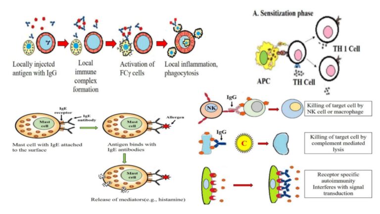 Hypersensitivity - Definition, Types, Mechanisms, Examples
