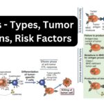 Tumors - Types, Tumor Antigens, Risk Factors