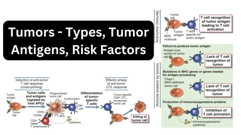 Tumors - Types, Tumor Antigens, Risk Factors