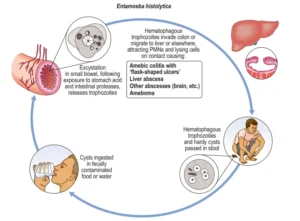 Gastrointestinal Amebiasis by Entamoeba histolytica