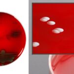 Columbia CNA Agar - Composition, Preparation, Uses, and Results