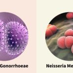 What is the Difference Between Neisseria Gonorrhoeae and Neisseria Meningitidis
