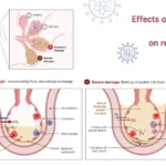 The progression of SARS-CoV-2 infection throughout the respiratory system