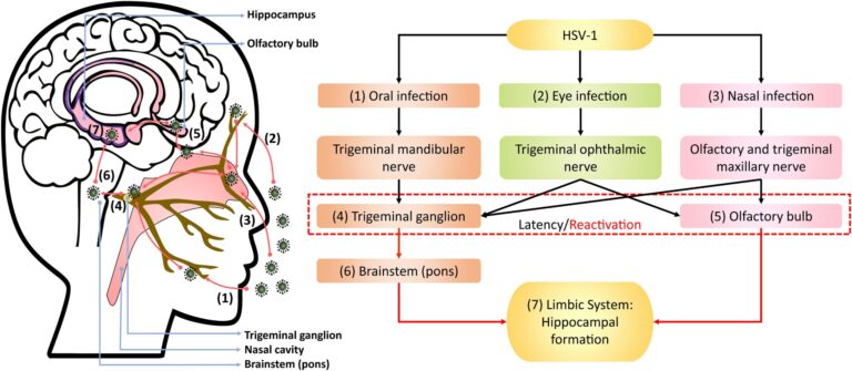 Herpes simplex virus 1 (HSV-1)