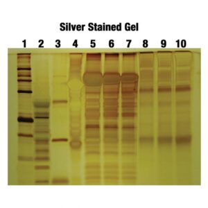 Silver Staining – Principle, Procedure, Applications