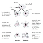 Necrosis - Definition, Types, Mechanism, Causes