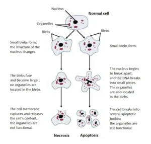 Necrosis – Definition, Types, Mechanism, Causes