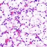 Results and Interpretation of Hematoxylin and Eosin (H&E) Staining