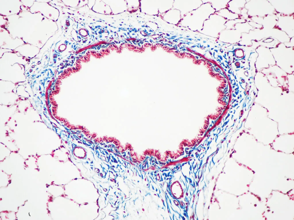 Rat airway stained with Masson's trichrome The connective tissue is dyed blue, while the nuclei and cytoplasm are stained dark red/purple and red/pink, respectively.