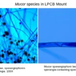 Lactophenol Cotton Blue (LPCB) Mounts