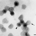 Negative stain of an enveloped virus with such short surface projections that they are not often visible in negative stains (rubella virus); the nucleocapsids inside are not morphologically distinct. Some particles are outlined by the stain, showing the surface of the virus (arrow), and some are penetrated by the stain (arrowhead) allowing visualization of the interior of the virus. Bar, 100 nm. Magnification, ϫ 100,000. (Reprinted from reference 56 with permission of John Wiley & Sons, Inc. Copyright 1986 Wiley-Liss, Inc., a subsidiary of John Wiley & Sons, Inc.)