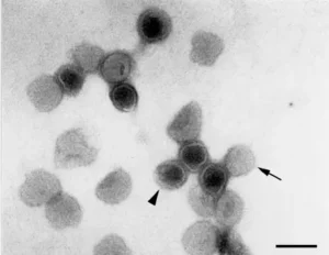 Negative staining of Viruses – Principle, Procedure, Uses