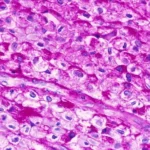 Periodic Acid-Schiff (PAS) Staining