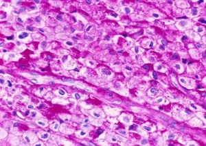 Periodic Acid-Schiff (PAS) Staining – Principle, Procedure, result, Uses