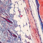 Mouse skin stained with Masson's trichrome stain.