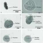 Wheatley Trichrome Staining - Principle, Procedure, Uses