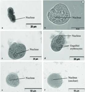 Wheatley Trichrome Staining – Principle, Procedure, Uses