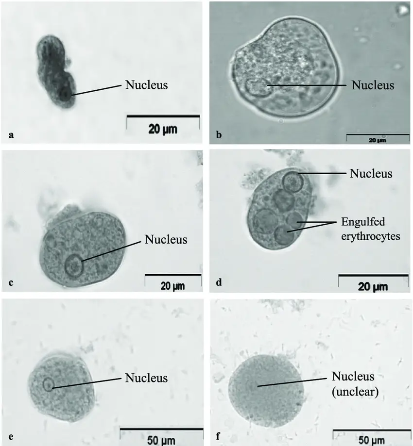 Wheatley Trichrome Staining - Principle, Procedure, Uses