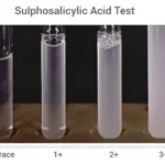 Sulphosalicylic Acid Test for Proteinuria - Principle, Procedure, Result, Uses