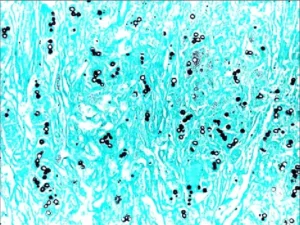 Grocott-Gomori’s Methenamine Silver Staining – Principle, Procedure, Applications