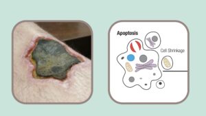 Apoptosis vs. Necrosis – Definition, Types, Causes