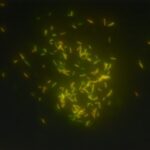 Result and Interpretation of Auramine- Rhodamine Staining